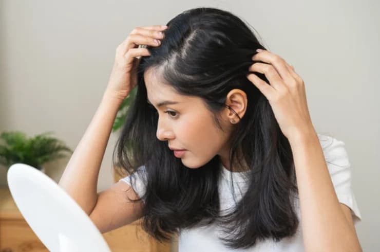 Hair & Scalp Disorders